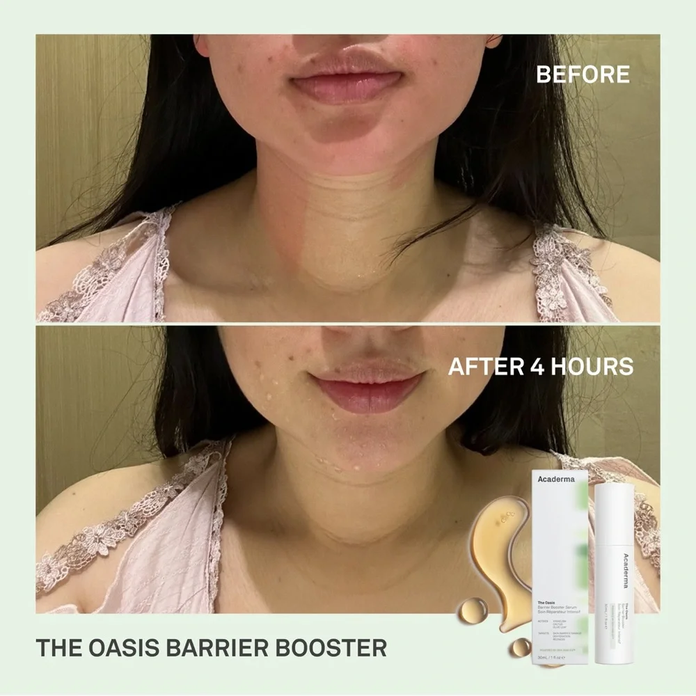 3/$15 Acaderma The Oasis Barrier Booster Serum Mini Size